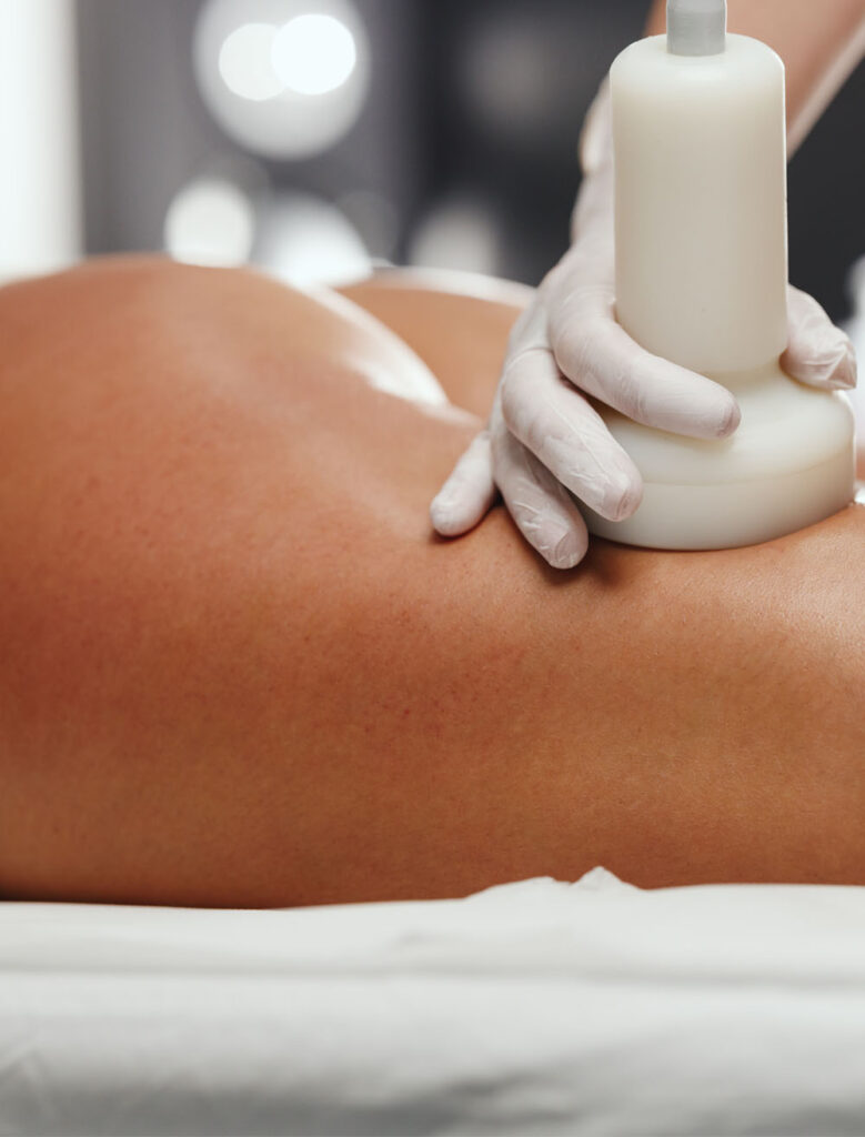 CELLULITE REDUCTION