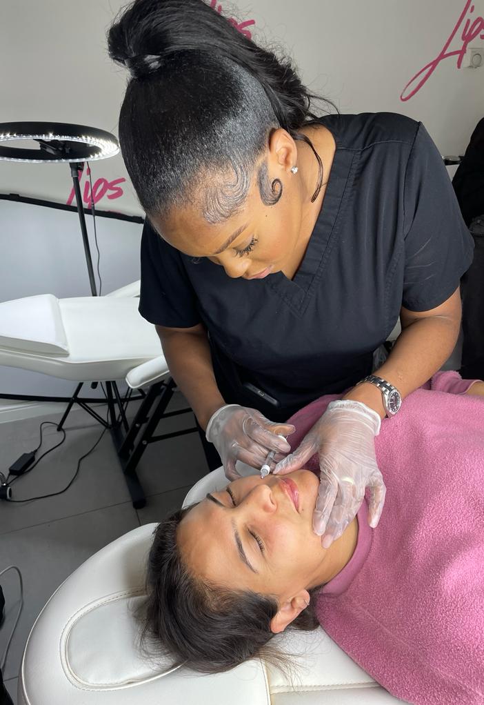 Face filler - Nasolabial folds